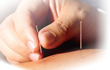 Acupuncture For Orlando Acupuncture Clinic