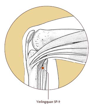 Pain Relief by Orlando Acupuncturists Christina Prieto