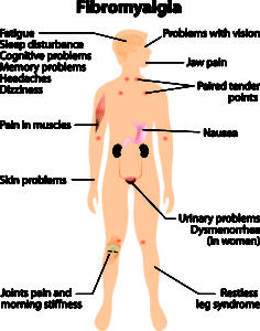 Fibromyalgia Natural Treatment With Chinese Medicine - Harmony Wellness Center